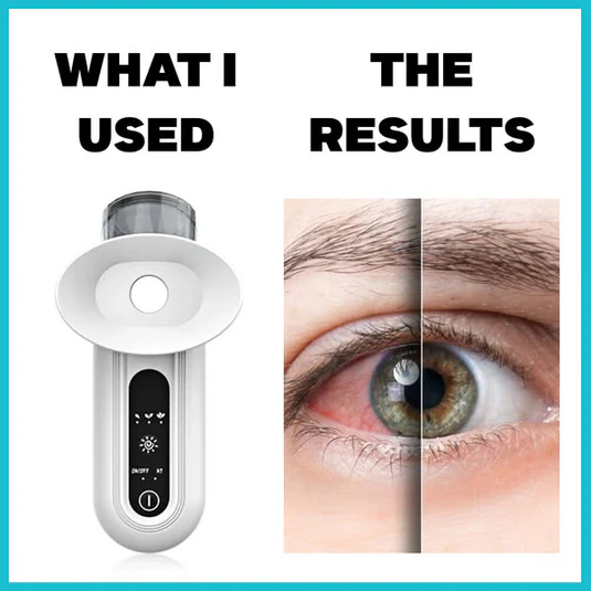 Steam Therapy Wand